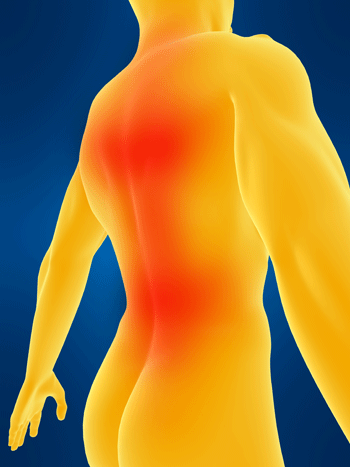 Back Pain Leading Cause of Global Disability 