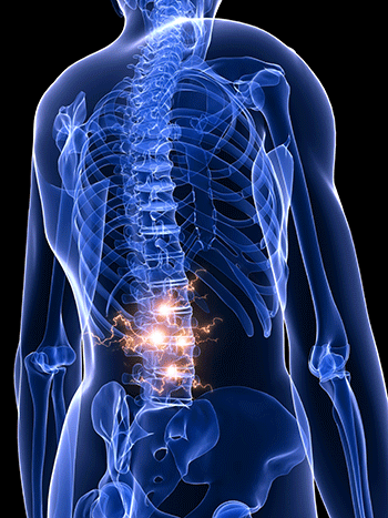 Degeneration spine chiropractic