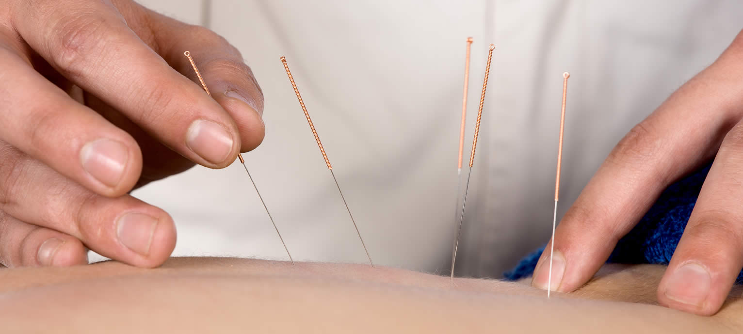 wirral medical acupuncture | wirral chiropractor